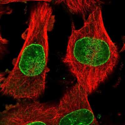 Immunocytochemistry/ Immunofluorescence: Nup153 Antibody [NBP1-81724]