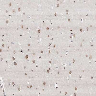 Immunohistochemistry-Paraffin: Nup153 Antibody [NBP1-81723]