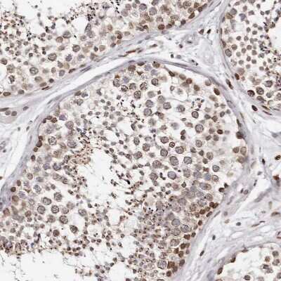 Immunohistochemistry-Paraffin: Nup153 Antibody [NBP1-81723]
