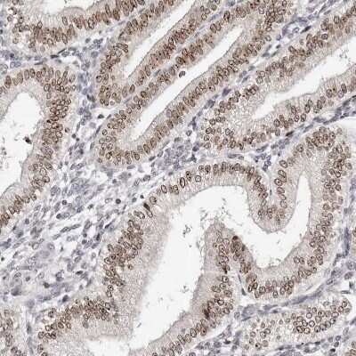 Immunohistochemistry-Paraffin: Nup153 Antibody [NBP1-81723]