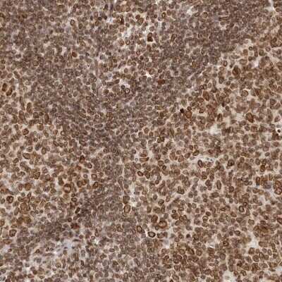 Immunohistochemistry-Paraffin: Nup153 Antibody [NBP1-81724]
