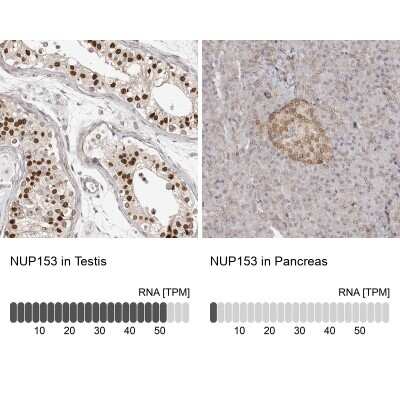 Immunohistochemistry-Paraffin: Nup153 Antibody [NBP1-81725]