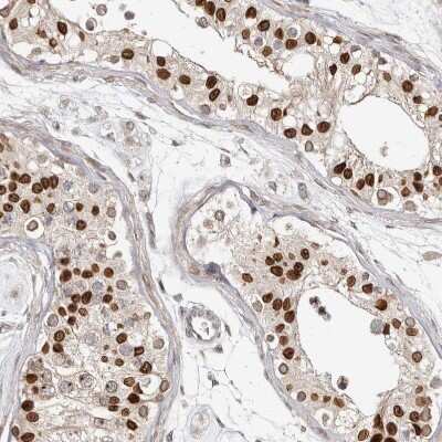 Immunohistochemistry-Paraffin: Nup153 Antibody [NBP1-81725]
