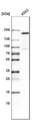 Western Blot: Nup153 Antibody [NBP1-81725]