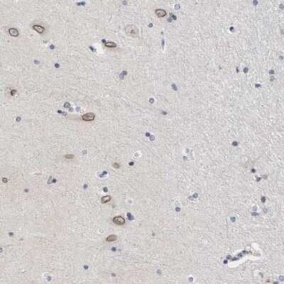 Immunohistochemistry-Paraffin: Nup53 Antibody [NBP1-92213]