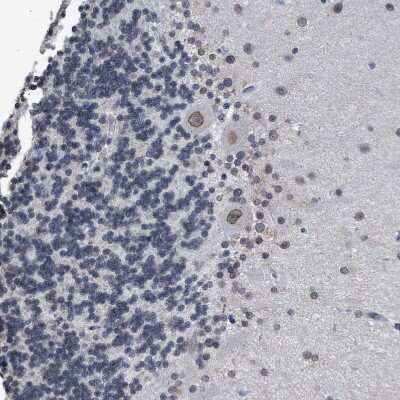 Immunohistochemistry-Paraffin: Nup53 Antibody [NBP1-92214]
