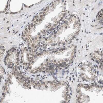 Immunohistochemistry-Paraffin: Nup53 Antibody [NBP1-92214]
