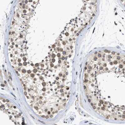 Immunohistochemistry-Paraffin: Nup53 Antibody [NBP1-92214]
