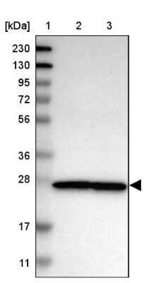 Western Blot: Nup53 Antibody [NBP1-92212]