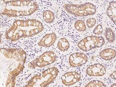 Immunohistochemistry-Paraffin: Nurim Antibody [NBP2-99482]