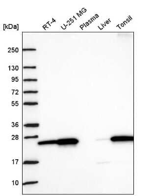 Western Blot: Nurim Antibody [NBP2-56443]