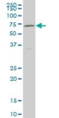 Western Blot: Nurr1/NGFI-B beta/NR4A2 Antibody (1C6) [H00004929-M10]