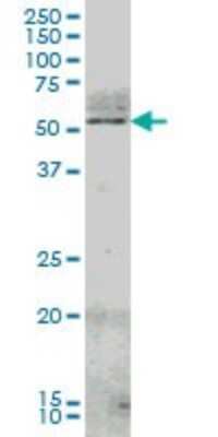 Western Blot: Nurr1/NGFI-B beta/NR4A2 Antibody (1G6) [H00004929-M02]