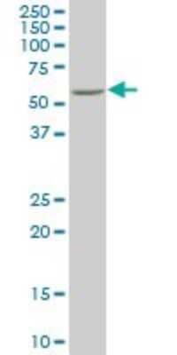 Western Blot: Nurr1/NGFI-B beta/NR4A2 Antibody (1G6) [H00004929-M02]