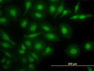 Immunocytochemistry/ Immunofluorescence: Nurr1/NGFI-B beta/NR4A2 Antibody (2G5) [H00004929-M08]