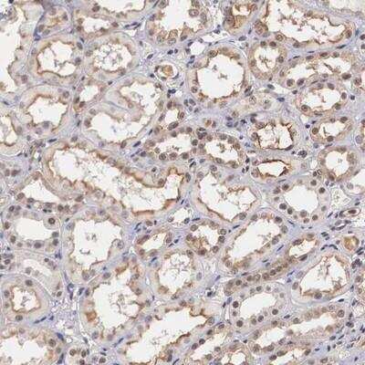 Immunohistochemistry-Paraffin: Nurr1/NGFI-B beta/NR4A2 Antibody [NBP1-87765]