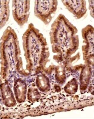 Immunohistochemistry: O-GlcNAc Antibody (RL2) - Azide and BSA Free [NBP2-80892]