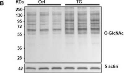 Western Blot: O-GlcNAc Antibody (RL2)BSA Free [NB300-524]