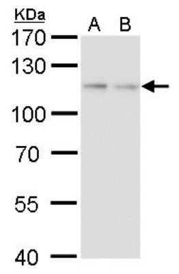 Western Blot: O-GlcNAc Transferase p110 subunit Antibody (2037) [NBP2-43755]