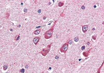 Immunohistochemistry-Paraffin: O-GlcNAc Transferase p110 subunit Antibody [NB100-57845]