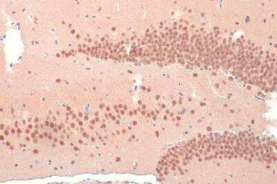 Immunohistochemistry-Paraffin: O-GlcNAc Transferase p110 subunit Antibody [NBP1-32791]