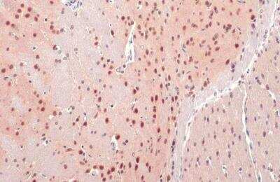Immunohistochemistry-Paraffin: O-GlcNAc Transferase p110 subunit Antibody [NBP1-32791]