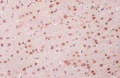 Immunohistochemistry-Paraffin: O-GlcNAc Transferase p110 subunit Antibody [NBP1-32791]