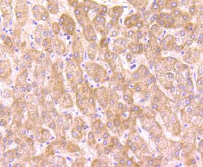 Immunohistochemistry-Paraffin: O-GlcNAc Transferase p110 subunit Antibody (JB44-39) [NBP2-75601]