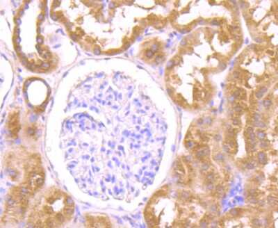 Immunohistochemistry-Paraffin: O-GlcNAc Transferase p110 subunit Antibody (JB44-39) [NBP2-75601]