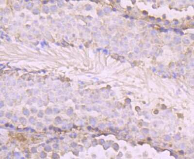 Immunohistochemistry-Paraffin: O-GlcNAc Transferase p110 subunit Antibody (JB44-39) [NBP2-75601]