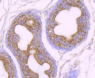 Immunohistochemistry-Paraffin: O-GlcNAc Transferase p110 subunit Antibody (JB44-39) [NBP2-75601]