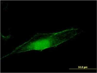 Immunocytochemistry/ Immunofluorescence: O-GlcNAcase/OGA/MGEA5 Antibody (1C7) [H00010724-M02]