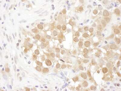 Immunohistochemistry-Paraffin: O-GlcNAcase/OGA/MGEA5 Antibody [NBP2-32233]