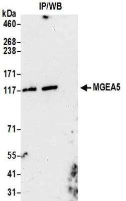 Immunoprecipitation: O-GlcNAcase/OGA/MGEA5 Antibody [NBP2-32233]