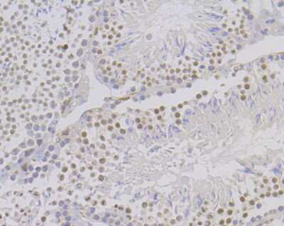 Immunohistochemistry-Paraffin: O-GlcNAcase/OGA/MGEA5 Antibody (JG40-05) [NBP2-76848]