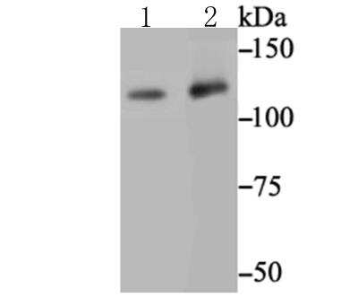 Western Blot: O-GlcNAcase/OGA/MGEA5 Antibody (JG40-05) [NBP2-76848]