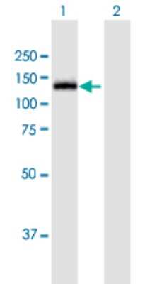 Western Blot: O-GlcNAcase/OGA/MGEA5 Antibody [H00010724-B01P]