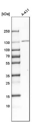 Western Blot: O-GlcNAcase/OGA/MGEA5 Antibody [NBP1-81244]