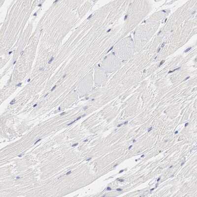 Immunohistochemistry-Paraffin: OA1 Antibody [NBP2-14066]