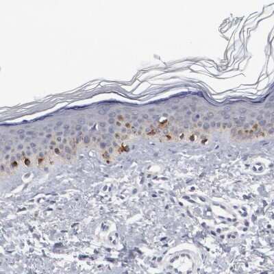 Immunohistochemistry-Paraffin: OA1 Antibody [NBP2-14066]