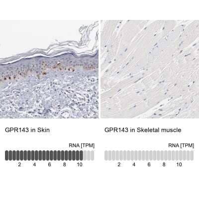 Immunohistochemistry-Paraffin: OA1 Antibody [NBP2-14066]