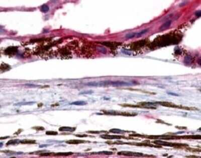 Immunohistochemistry-Paraffin: OA1 Antibody - BSA Free [NLS2128]