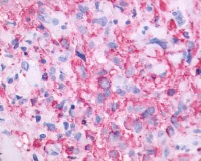 Immunohistochemistry-Paraffin: OA1 Antibody - BSA Free [NLS2128]