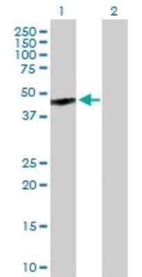 Western Blot: OA1 Antibody [H00004935-B01P]