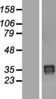 Western Blot: OAF Overexpression Lysate [NBP2-04957]