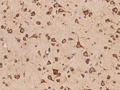 Immunohistochemistry-Paraffin: OARD1 Antibody [NBP2-98177]