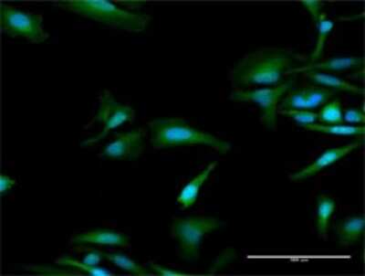 Immunocytochemistry/ Immunofluorescence: OAS1 Antibody [H00004938-D03P]