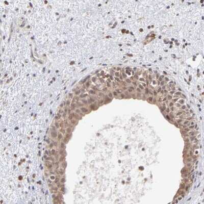 Immunohistochemistry-Paraffin: OAS1 Antibody [NBP1-83122]