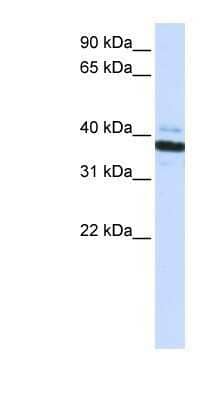 Western Blot: OAS1 Antibody [NBP1-58950]