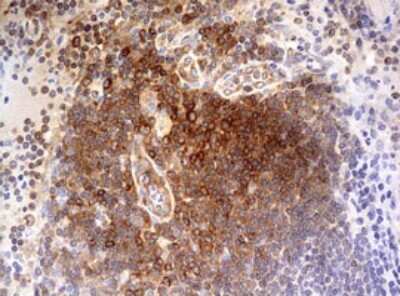 Immunohistochemistry: OAS2 Antibody (OTI6E6) [NBP2-46293]
